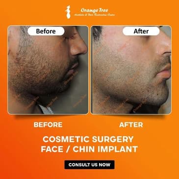Slider image (5) Orange Tree Aesthetic And Hair Restoration Centre